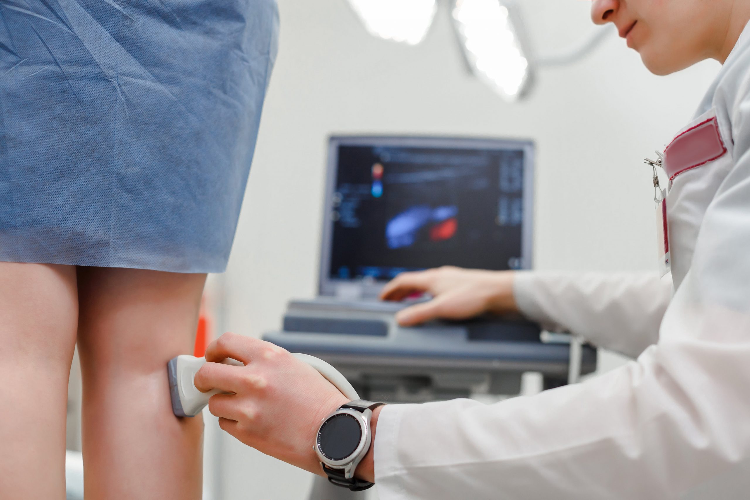 Ultrassom vascular