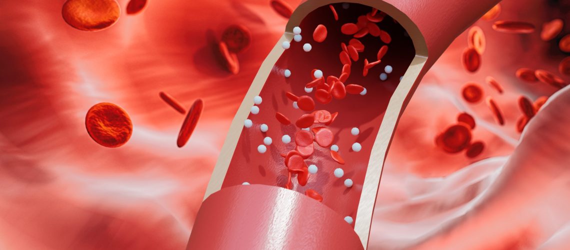 cirurgia vascular