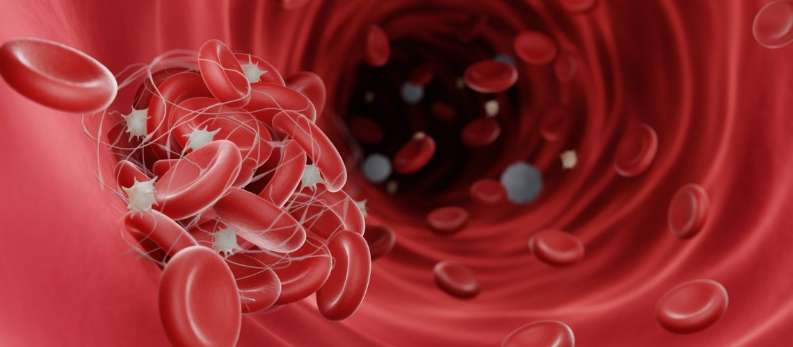 Coágulos sanguíneos