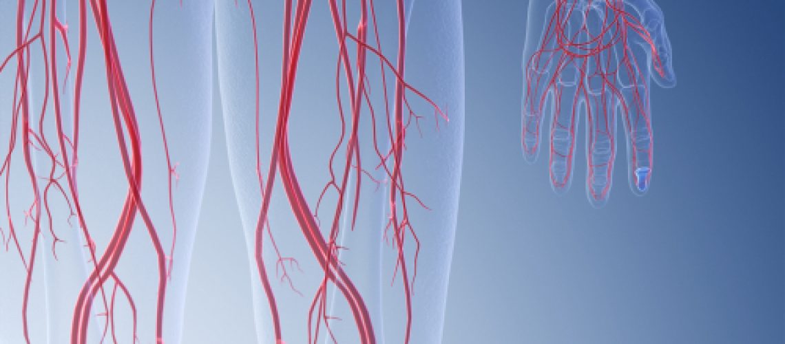 Doença arterial periférica