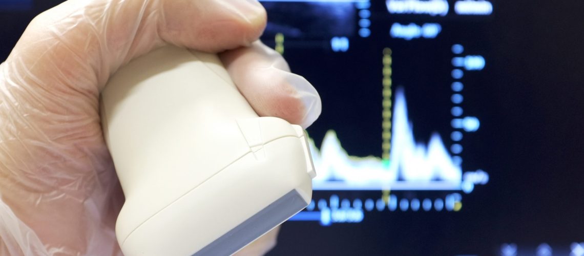 Linear ultrasound probe with vascular doppler exam in background